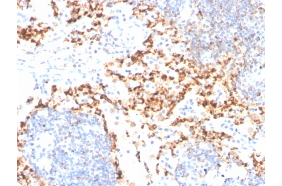 Immunohistochemistry - Anti-TIM3 Antibody [TIM3/4029] - BSA and Azide free (A253605) - Antibodies.com