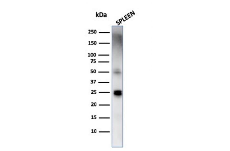 Western Blot - Anti-TIM3 Antibody [TIM3/4029] - BSA and Azide free (A253605) - Antibodies.com
