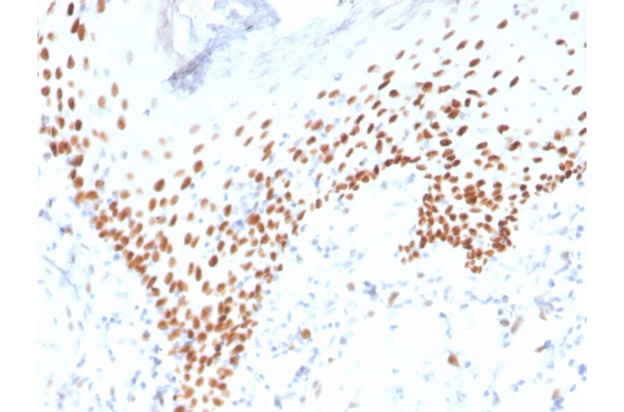 Immunohistochemistry - Anti-p40 Antibody [rTP40/3690] - BSA and Azide free (A253607) - Antibodies.com