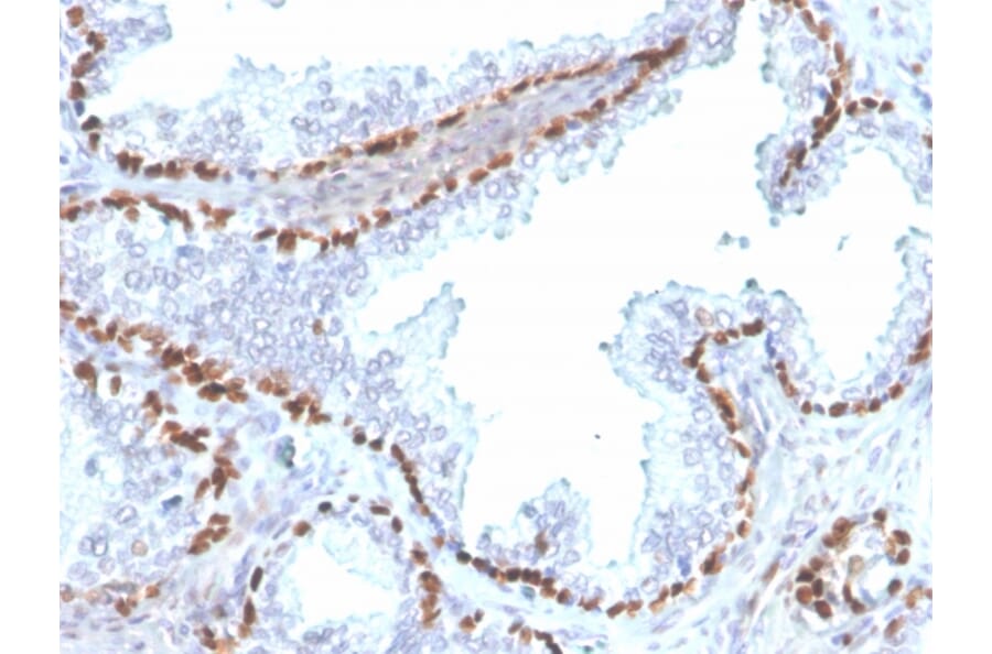 Immunohistochemistry - Anti-p40 Antibody [rTP40/3690] - BSA and Azide free (A253607) - Antibodies.com