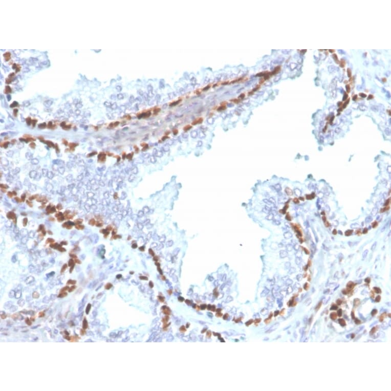 Immunohistochemistry - Anti-p40 Antibody [rTP40/3690] - BSA and Azide free (A253607) - Antibodies.com
