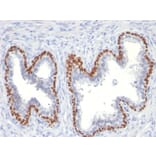 Immunohistochemistry - Anti-p63 Antibody [TP63/11] - BSA and Azide free (A253607) - Antibodies.com