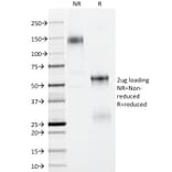 SDS-PAGE - Anti-p63 Antibody [TP63/11] - BSA and Azide free (A253608) - Antibodies.com