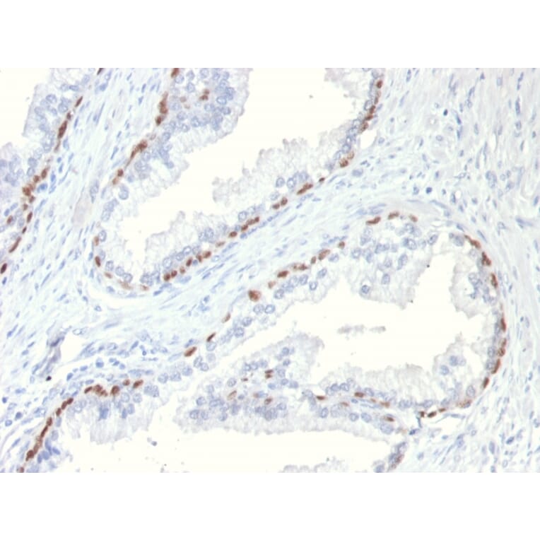 Immunohistochemistry - Anti-p63 Antibody [TP63/11] - BSA and Azide free (A253608) - Antibodies.com