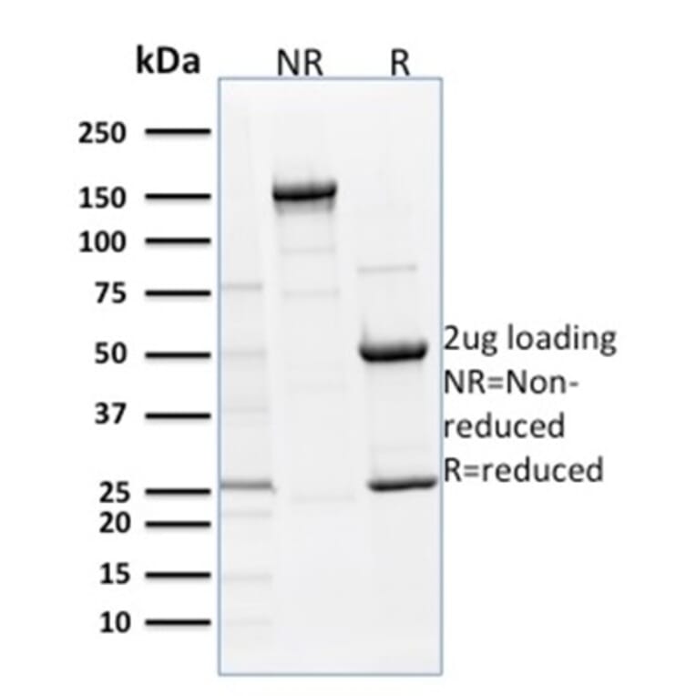 SDS-PAGE - Anti-p63 Antibody [TP63/1786] - BSA and Azide free (A253609) - Antibodies.com