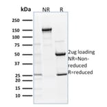 SDS-PAGE - Anti-p63 Antibody [TP63/1786] - BSA and Azide free (A253609) - Antibodies.com