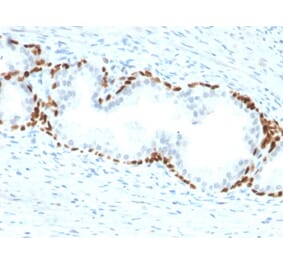Immunohistochemistry - Anti-p63 Antibody [TP63/2428] - BSA and Azide free (A253611) - Antibodies.com
