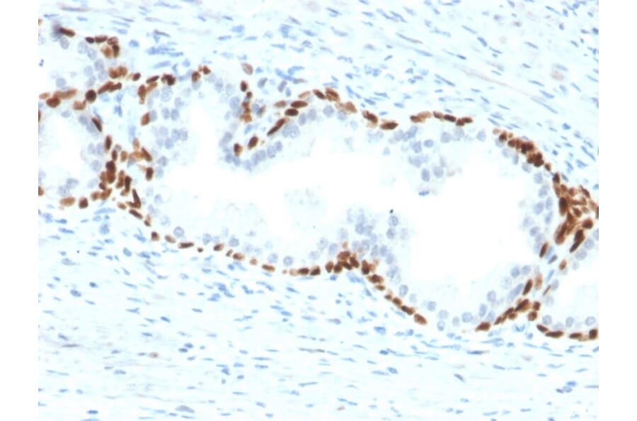 Immunohistochemistry - Anti-p63 Antibody [TP63/2428] - BSA and Azide free (A253611) - Antibodies.com