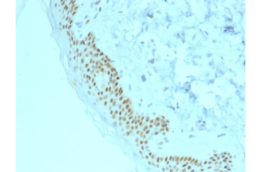 Immunohistochemistry - Anti-p63 Antibody [TP63/2428] - BSA and Azide free (A253611) - Antibodies.com