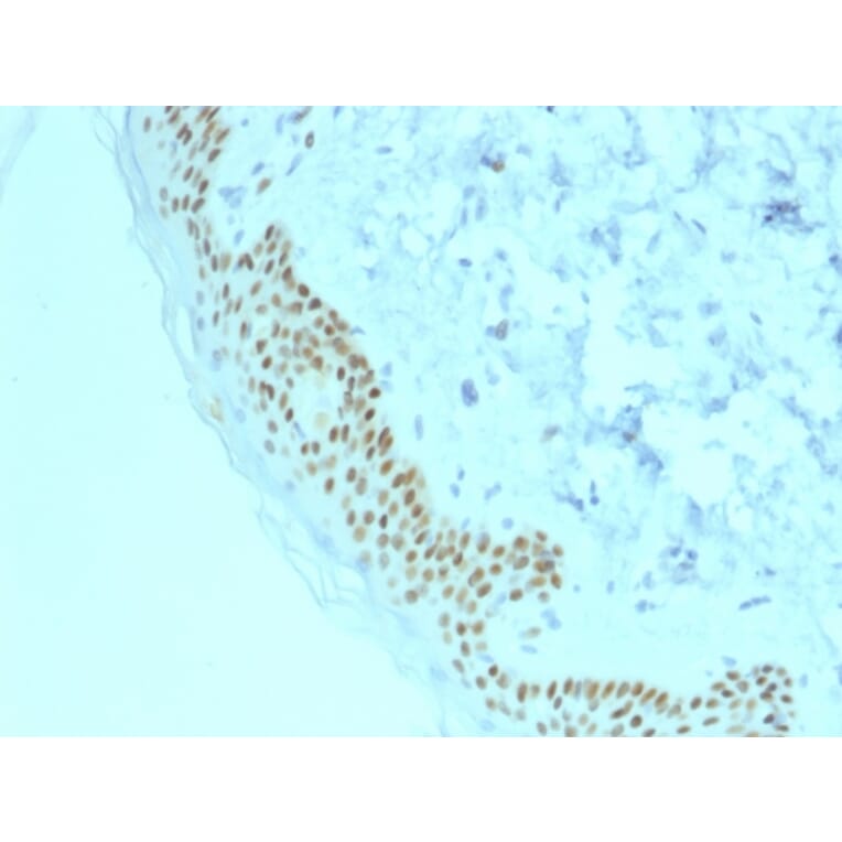 Immunohistochemistry - Anti-p63 Antibody [TP63/2428] - BSA and Azide free (A253611) - Antibodies.com