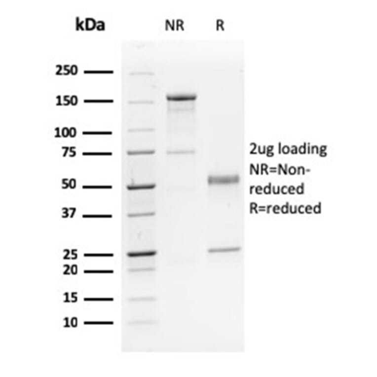 SDS-PAGE - Anti-p63 Antibody [TP63/2428] - BSA and Azide free (A253611) - Antibodies.com