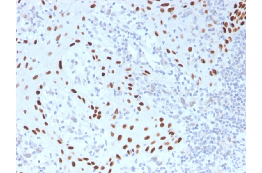 Immunohistochemistry - Anti-p40 Antibody [TP40/3980R] - BSA and Azide free (A253612) - Antibodies.com