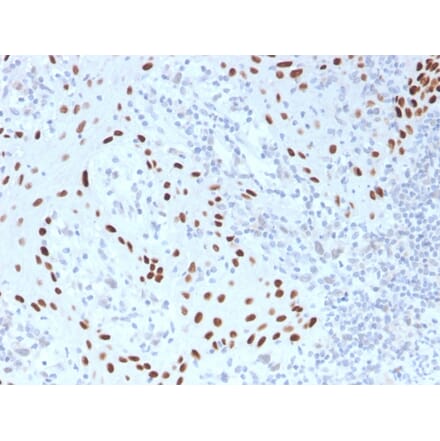 Immunohistochemistry - Anti-p40 Antibody [TP40/3980R] - BSA and Azide free (A253612) - Antibodies.com