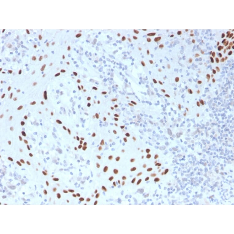 Immunohistochemistry - Anti-p40 Antibody [TP40/3980R] - BSA and Azide free (A253612) - Antibodies.com