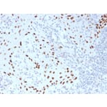 Immunohistochemistry - Anti-p40 Antibody [TP40/3980R] - BSA and Azide free (A253612) - Antibodies.com