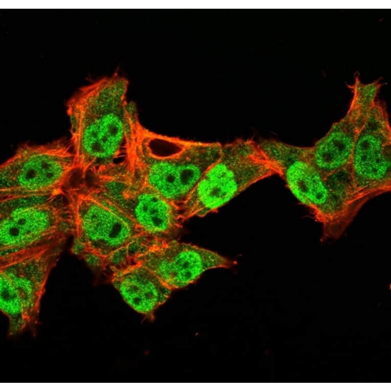 Immunofluorescence - Anti-p40 Antibody [TP40/3980R] - BSA and Azide free (A253612) - Antibodies.com