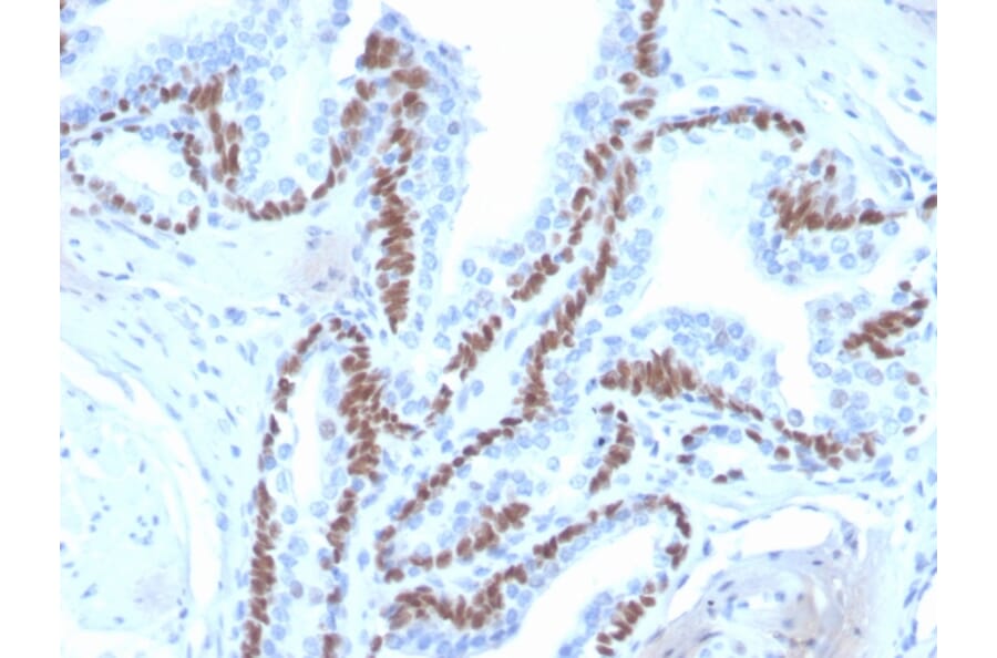Immunohistochemistry - Anti-p40 Antibody [ZR8] - BSA and Azide free (A253613) - Antibodies.com