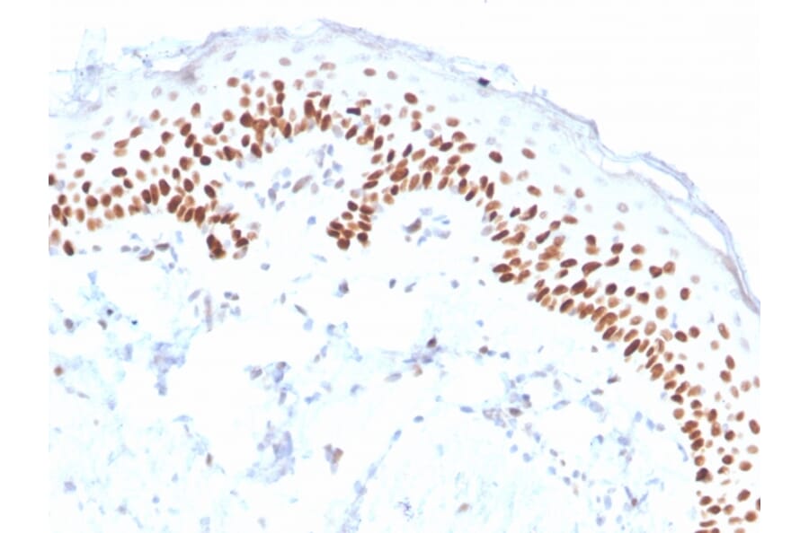 Immunohistochemistry - Anti-p40 Antibody [ZR8] - BSA and Azide free (A253613) - Antibodies.com
