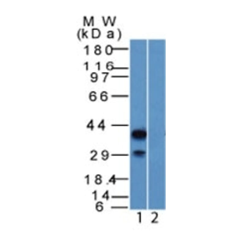 Western Blot - Anti-p40 Antibody - BSA and Azide free (A253615) - Antibodies.com