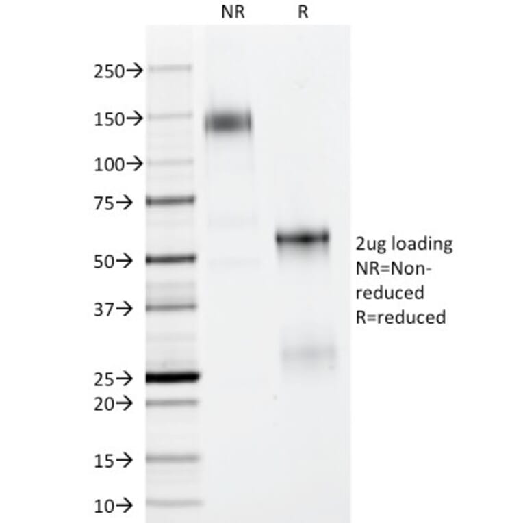 SDS-PAGE - Anti-p40 Antibody - BSA and Azide free (A253615) - Antibodies.com