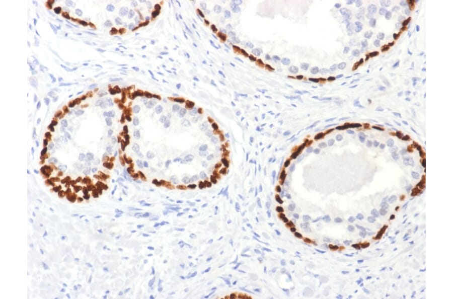 Immunohistochemistry - Anti-p63 Antibody - BSA and Azide free (A253615) - Antibodies.com