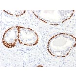 Immunohistochemistry - Anti-p63 Antibody - BSA and Azide free (A253615) - Antibodies.com