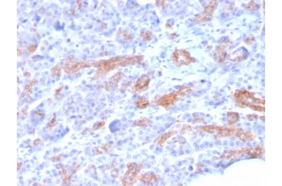 Immunohistochemistry - Anti-MRP3 Antibody [ABCC3/2971] - BSA and Azide free (A253618) - Antibodies.com