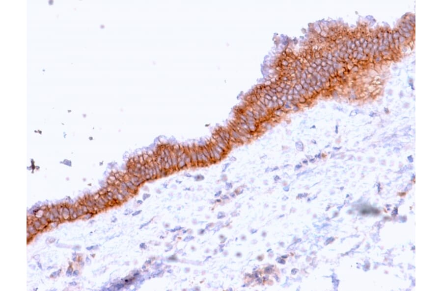 Immunohistochemistry - Anti-MRP3 Antibody [ABCC3/2971] - BSA and Azide free (A253618) - Antibodies.com