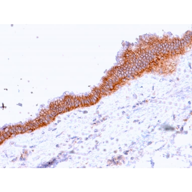 Immunohistochemistry - Anti-MRP3 Antibody [ABCC3/2971] - BSA and Azide free (A253618) - Antibodies.com
