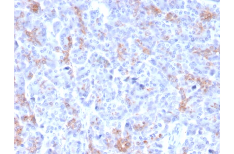 Immunohistochemistry - Anti-MRP3 Antibody [ABCC3/2971] - BSA and Azide free (A253618) - Antibodies.com