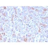 Immunohistochemistry - Anti-MRP3 Antibody [ABCC3/2971] - BSA and Azide free (A253618) - Antibodies.com