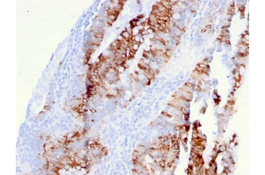 Immunohistochemistry - Anti-CD262 Antibody [DR5/3381] - BSA and Azide free (A253621) - Antibodies.com