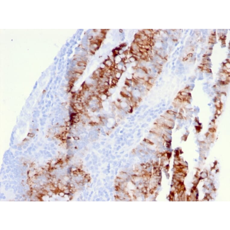 Immunohistochemistry - Anti-CD262 Antibody [DR5/3381] - BSA and Azide free (A253621) - Antibodies.com