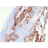 Immunohistochemistry - Anti-CD262 Antibody [DR5/3381] - BSA and Azide free (A253621) - Antibodies.com