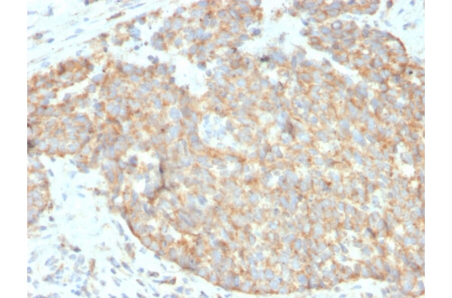 Immunohistochemistry - Anti-CD262 Antibody [DR5/3381] - BSA and Azide free (A253621) - Antibodies.com