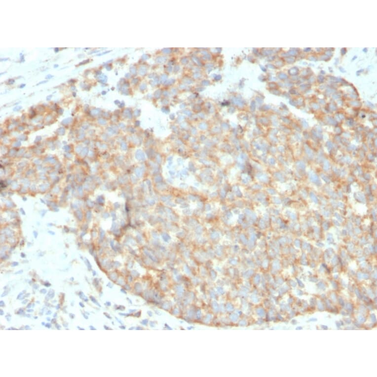 Immunohistochemistry - Anti-CD262 Antibody [DR5/3381] - BSA and Azide free (A253621) - Antibodies.com