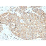Immunohistochemistry - Anti-CD262 Antibody [DR5/3381] - BSA and Azide free (A253621) - Antibodies.com