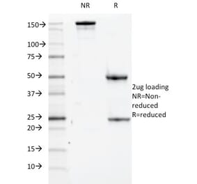 SDS-PAGE - Anti-CD84 Antibody [152-1D5] - BSA and Azide free (A253623) - Antibodies.com