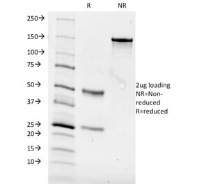 SDS-PAGE - Anti-CD84 Antibody [153-4D9] - BSA and Azide free (A253624) - Antibodies.com