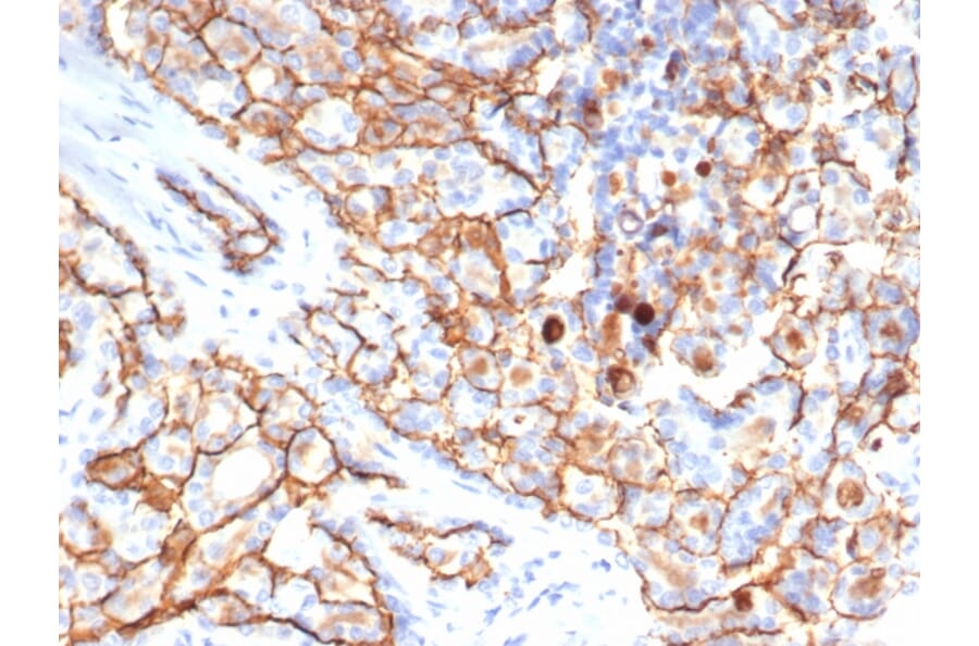 Immunohistochemistry - Anti-CD133 Antibody [HB#7] - BSA and Azide free (A253624) - Antibodies.com