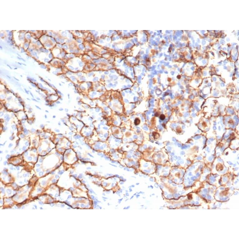 Immunohistochemistry - Anti-CD133 Antibody [HB#7] - BSA and Azide free (A253624) - Antibodies.com