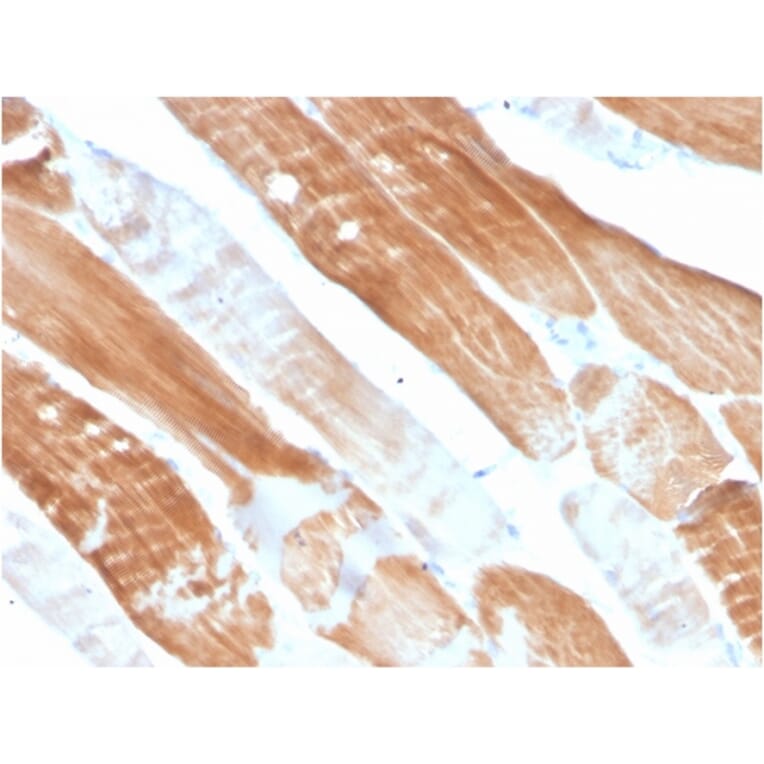 Immunohistochemistry - Anti-Sarcomeric Actinin alpha 2 Antibody [ACTN2/3291] - BSA and Azide free (A253627) - Antibodies.com