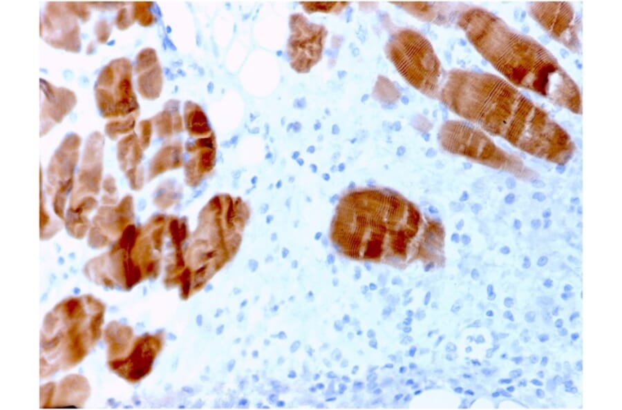 Immunohistochemistry - Anti-Sarcomeric Actinin alpha 2 Antibody [ACTN2/3291] - BSA and Azide free (A253627) - Antibodies.com