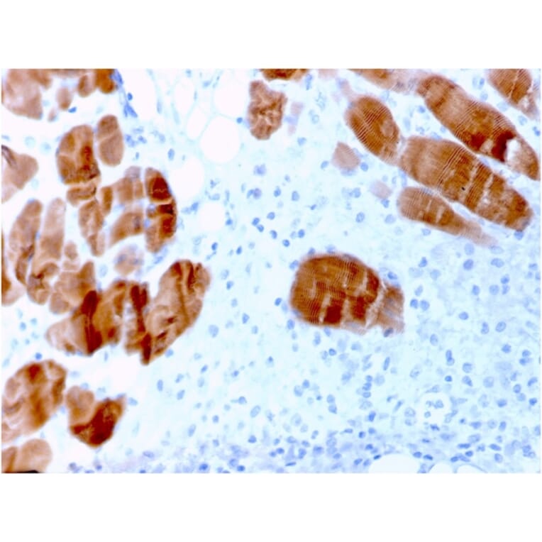 Immunohistochemistry - Anti-Sarcomeric Actinin alpha 2 Antibody [ACTN2/3291] - BSA and Azide free (A253627) - Antibodies.com