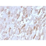 Immunohistochemistry - Anti-Sarcomeric Actinin alpha 2 Antibody [ACTN2/3291] - BSA and Azide free (A253627) - Antibodies.com