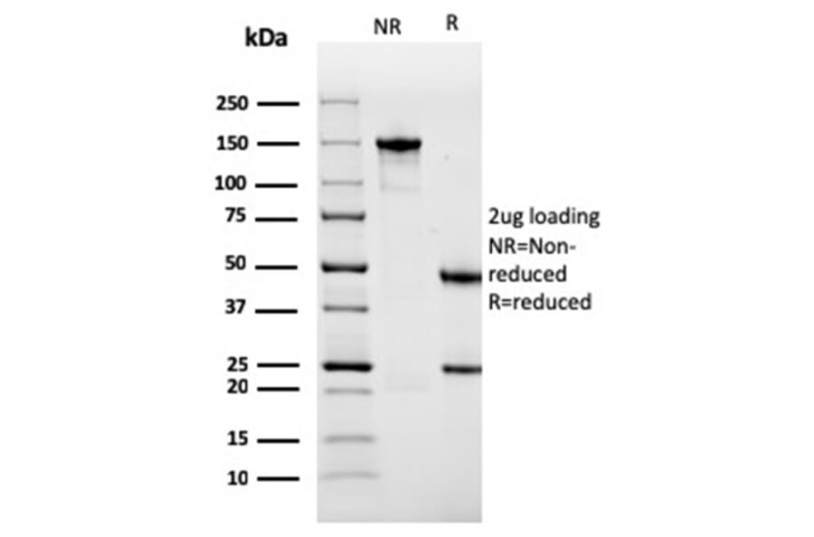 SDS-PAGE - Anti-Sarcomeric Actinin alpha 2 Antibody [ACTN2/3291] - BSA and Azide free (A253627) - Antibodies.com
