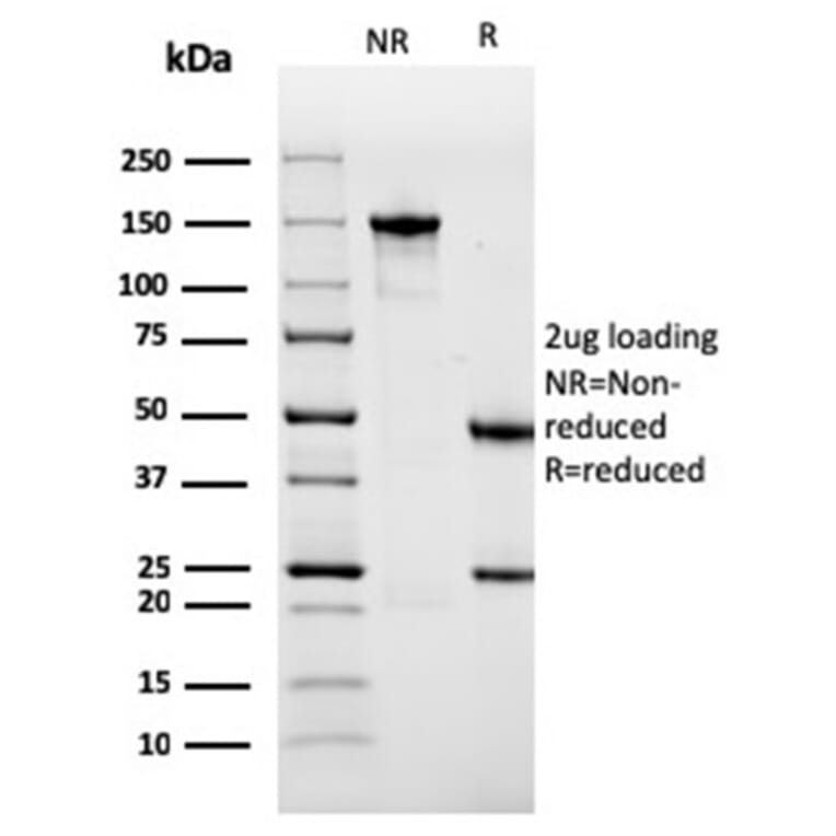 SDS-PAGE - Anti-Sarcomeric Actinin alpha 2 Antibody [ACTN2/3291] - BSA and Azide free (A253627) - Antibodies.com