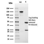 SDS-PAGE - Anti-Sarcomeric Actinin alpha 2 Antibody [ACTN2/3291] - BSA and Azide free (A253627) - Antibodies.com