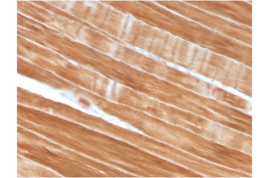 Immunohistochemistry - Anti-Sarcomeric Actinin alpha 2 Antibody [ACTN2/3292] - BSA and Azide free (A253628) - Antibodies.com