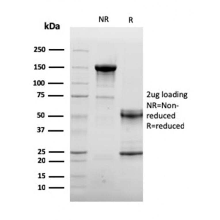 SDS-PAGE - Anti-Sarcomeric Actinin alpha 2 Antibody [ACTN2/3292] - BSA and Azide free (A253628) - Antibodies.com